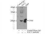 Rac1 Antibody in Immunoprecipitation (IP)