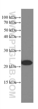 Rac1 Antibody in Western Blot (WB)