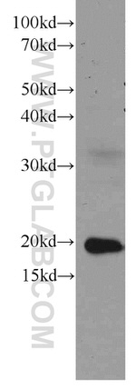 Rac1 Antibody in Western Blot (WB)