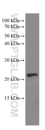 Rac1 Antibody in Western Blot (WB)