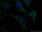 Kininogen 1 Antibody in Immunocytochemistry (ICC/IF)