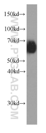 Kininogen 1 Antibody in Western Blot (WB)