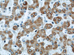 APOL1 Antibody in Immunohistochemistry (Paraffin) (IHC (P))