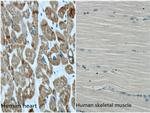 ACTC1 Antibody in Immunohistochemistry (Paraffin) (IHC (P))