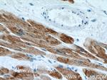 ACTC1 Antibody in Immunohistochemistry (Paraffin) (IHC (P))