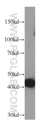 ACTC1 Antibody in Western Blot (WB)