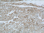 ACTC1 Antibody in Immunohistochemistry (Paraffin) (IHC (P))