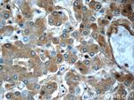 Alpha-2-macroglobulin Antibody in Immunohistochemistry (Paraffin) (IHC (P))