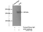 Alpha-2-macroglobulin Antibody in Immunoprecipitation (IP)