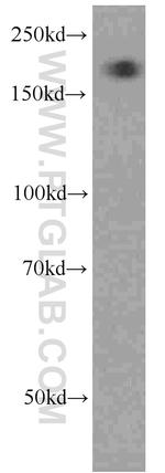 Alpha-2-macroglobulin Antibody in Western Blot (WB)