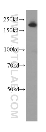 Alpha-2-macroglobulin Antibody in Western Blot (WB)