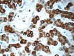 AK2 Antibody in Immunohistochemistry (Paraffin) (IHC (P))