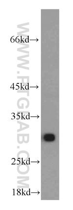 AK2 Antibody in Western Blot (WB)