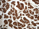 AK2 Antibody in Immunohistochemistry (Paraffin) (IHC (P))