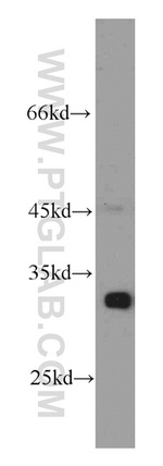 AK2 Antibody in Western Blot (WB)