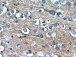 OXA1L Antibody in Immunohistochemistry (Paraffin) (IHC (P))