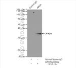 ARG1 Antibody in Immunoprecipitation (IP)