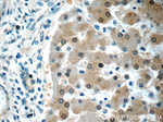 ARG1 Antibody in Immunohistochemistry (Paraffin) (IHC (P))