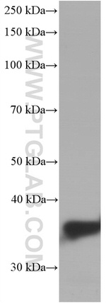 ARG1 Antibody in Western Blot (WB)