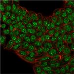 SUMO-2/3 Antibody in Immunocytochemistry (ICC/IF)