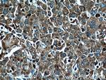 RPL3 Antibody in Immunohistochemistry (Paraffin) (IHC (P))