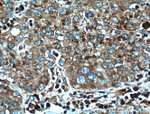 RPL3 Antibody in Immunohistochemistry (Paraffin) (IHC (P))