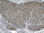 RPL3 Antibody in Immunohistochemistry (Paraffin) (IHC (P))