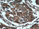 RPL3 Antibody in Immunohistochemistry (Paraffin) (IHC (P))