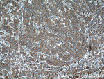 RPL3 Antibody in Immunohistochemistry (Paraffin) (IHC (P))