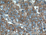 RPL3 Antibody in Immunohistochemistry (Paraffin) (IHC (P))