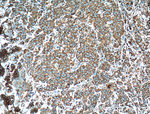 RPL3 Antibody in Immunohistochemistry (Paraffin) (IHC (P))