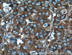 RPL3 Antibody in Immunohistochemistry (Paraffin) (IHC (P))