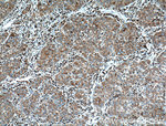 RPL3 Antibody in Immunohistochemistry (Paraffin) (IHC (P))