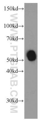 Amylase alpha Antibody in Western Blot (WB)