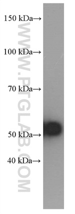 Amylase alpha Antibody in Western Blot (WB)