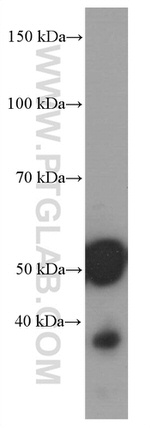 Amylase alpha Antibody in Western Blot (WB)