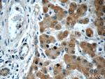 GOSR2/Membrin Antibody in Immunohistochemistry (Paraffin) (IHC (P))