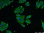 Alpha-1-Antitrypsin Antibody in Immunocytochemistry (ICC/IF)