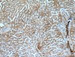 Alpha-1-Antitrypsin Antibody in Immunohistochemistry (Paraffin) (IHC (P))