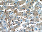 Alpha-1-Antitrypsin Antibody in Immunohistochemistry (Paraffin) (IHC (P))