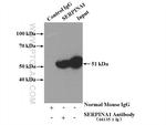 Alpha-1-Antitrypsin Antibody in Immunoprecipitation (IP)