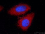 Alpha-1-Antitrypsin Antibody in Immunocytochemistry (ICC/IF)