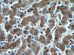 Alpha-1-Antitrypsin Antibody in Immunohistochemistry (Paraffin) (IHC (P))