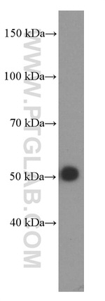 Alpha-1-Antitrypsin Antibody in Western Blot (WB)