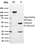 SIGLEC1/CD169/Sialoadhesin Antibody in SDS-PAGE (SDS-PAGE)