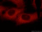 C9orf72 Antibody in Immunocytochemistry (ICC/IF)