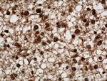 C9orf72 Antibody in Immunohistochemistry (Paraffin) (IHC (P))