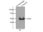 C9orf72 Antibody in Immunoprecipitation (IP)