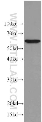 C9orf72 Antibody in Western Blot (WB)