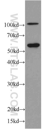 C9orf72 Antibody in Western Blot (WB)